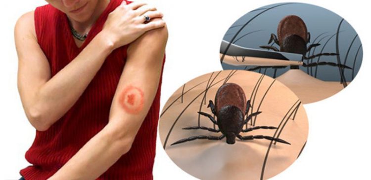 БНХАУ-д бүртгэгдсэн хачгаар дамждаг халдвараар долоон хүн нас баржээ