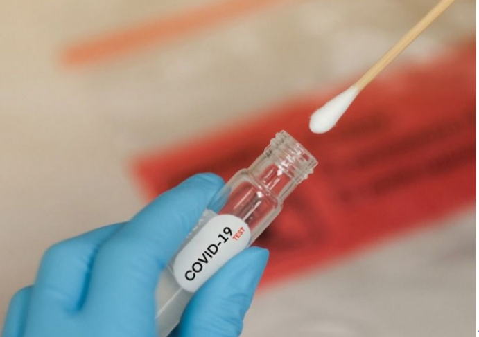 Нийт 58 мянган иргэн шинжилгээнд хамрагдаад байна