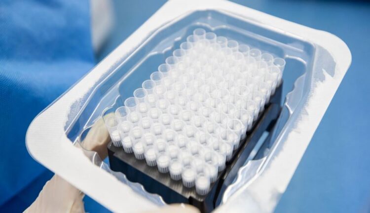 Улаанбаатар хотод 33, Төв аймагт халдварын 3 батлагдсан тохиолдол бүртгэгдлээ