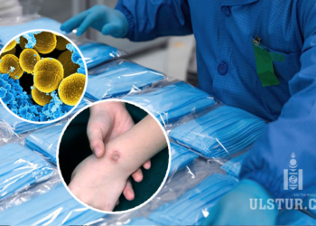 Импортоор орж ирдэг маскнаас илэрсэн үxлийн aюyлтай нян ‘Staphylococcus ‘ гэж юу вэ?