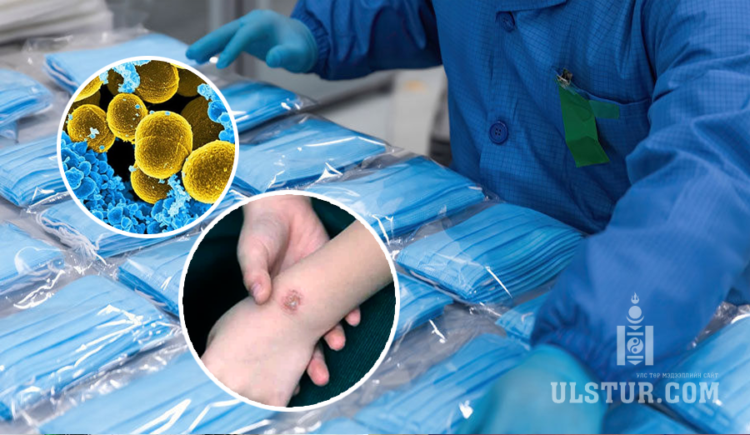Импортоор орж ирдэг маскнаас илэрсэн үxлийн aюyлтай нян ‘Staphylococcus ‘ гэж юу вэ?