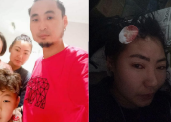 Иргэн Ган-Очирын эхнэр хүчиpxийлэлд өртсөн цочирдом зургуудаа олонд дэлгэлээ