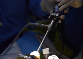 Монголд анх удаа донороос элэг дурангийн аргаар тайрах мэс заслыг амжилттай хийжээ